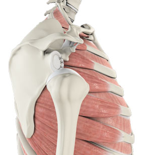Shoulder Labrum Reconstruction