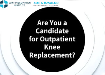 Are You a Candidate for Outpatient Knee Replacement?