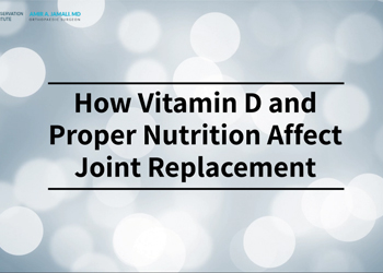How Vitamin D and Proper Nutrition Affect Your Joint Replacement
