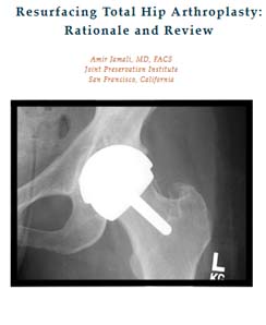 anterior approach total hip replacement in Pdf format