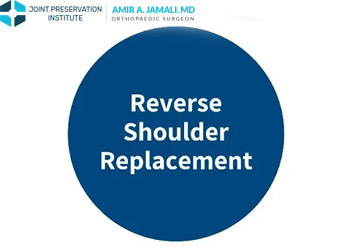 Reverse Shoulder Replacement