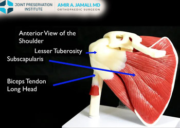 Rotator Cuff Tears: Anatomy and Imaging