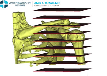 Understanding Your Medical Images: Xrays, CT scans, and MRI Images