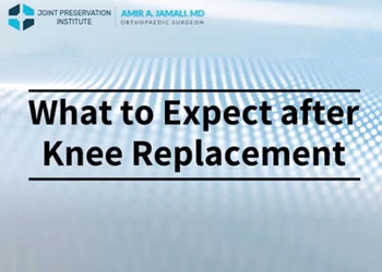 What to Expect after Knee Replacement